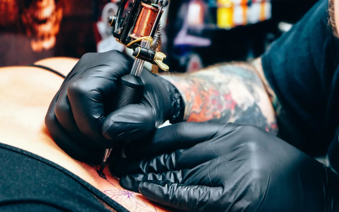 ¿Es posible eliminar un tatuaje por completo?