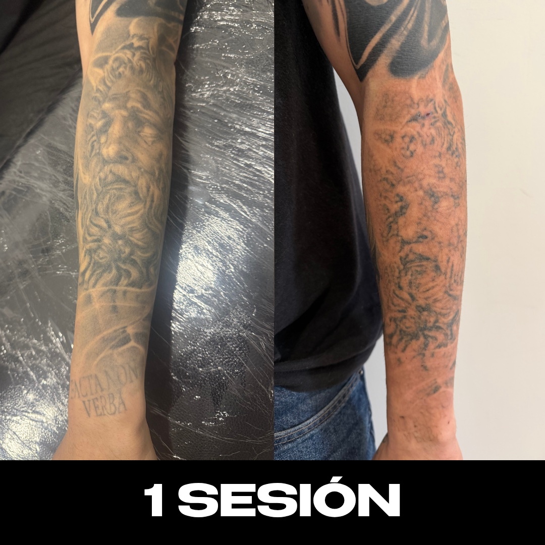 Trabajo de Alberto