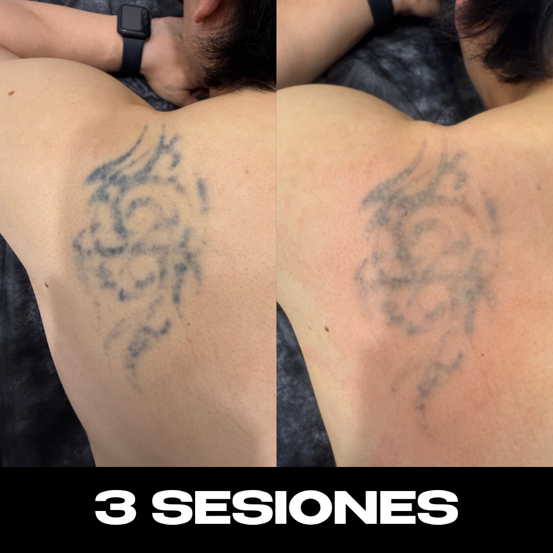 Trabajo de Alberto