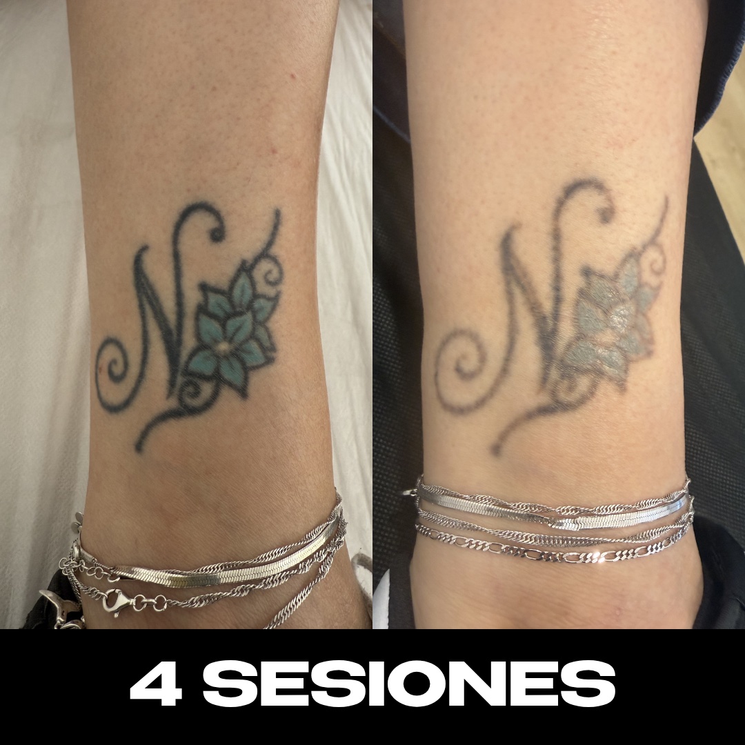 Trabajo de Alberto