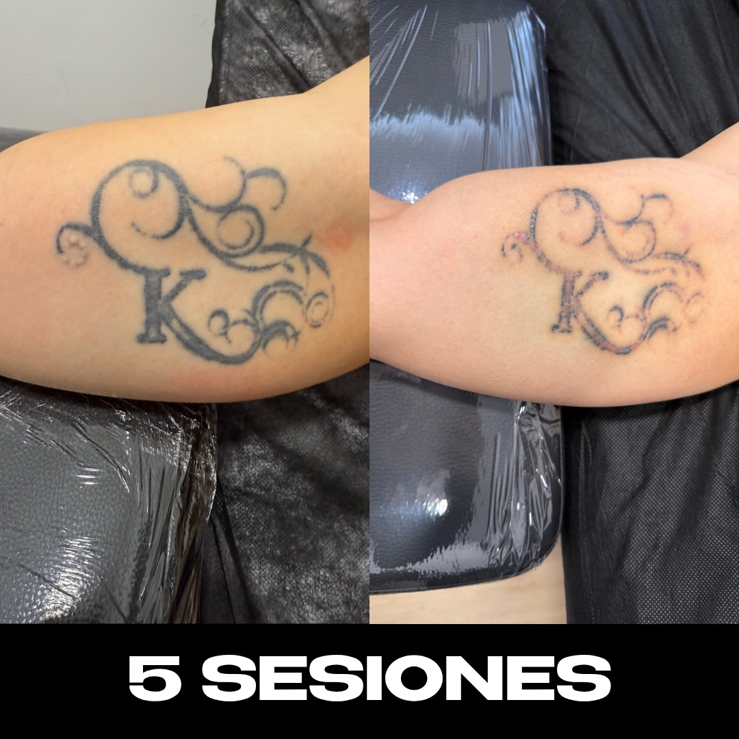 Trabajo de Alberto